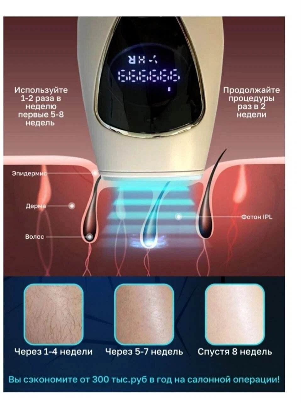 Фотоэпилятор лазерный эпилятор женский депилятор волос ipl A112 - фотография № 3