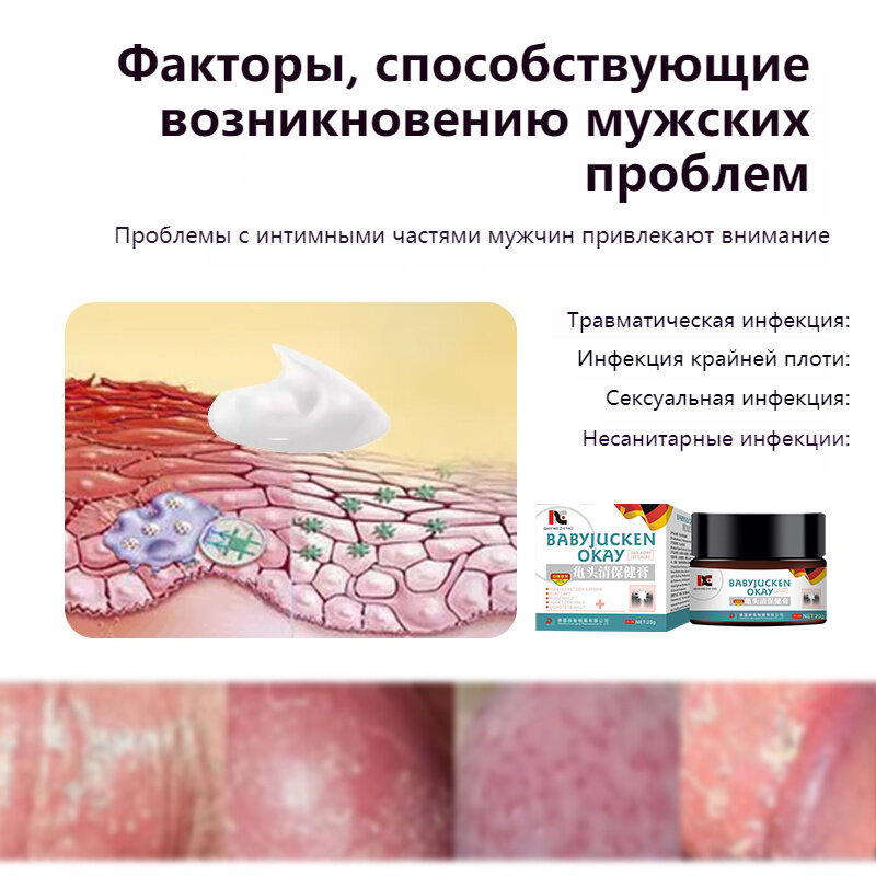 Изображение Немецкий антибактериальный крем от мужских инфекций, зуд и воспаление интимных частей тела, удаление грибков на гениталиях, выделений, 20 г
