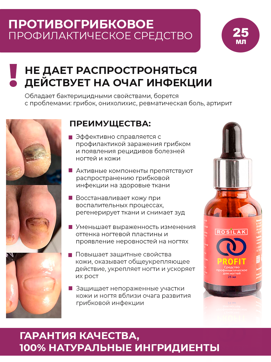Картинки Rosilak, PROFIT - профилактическое противогрибковое средство, 25 мл