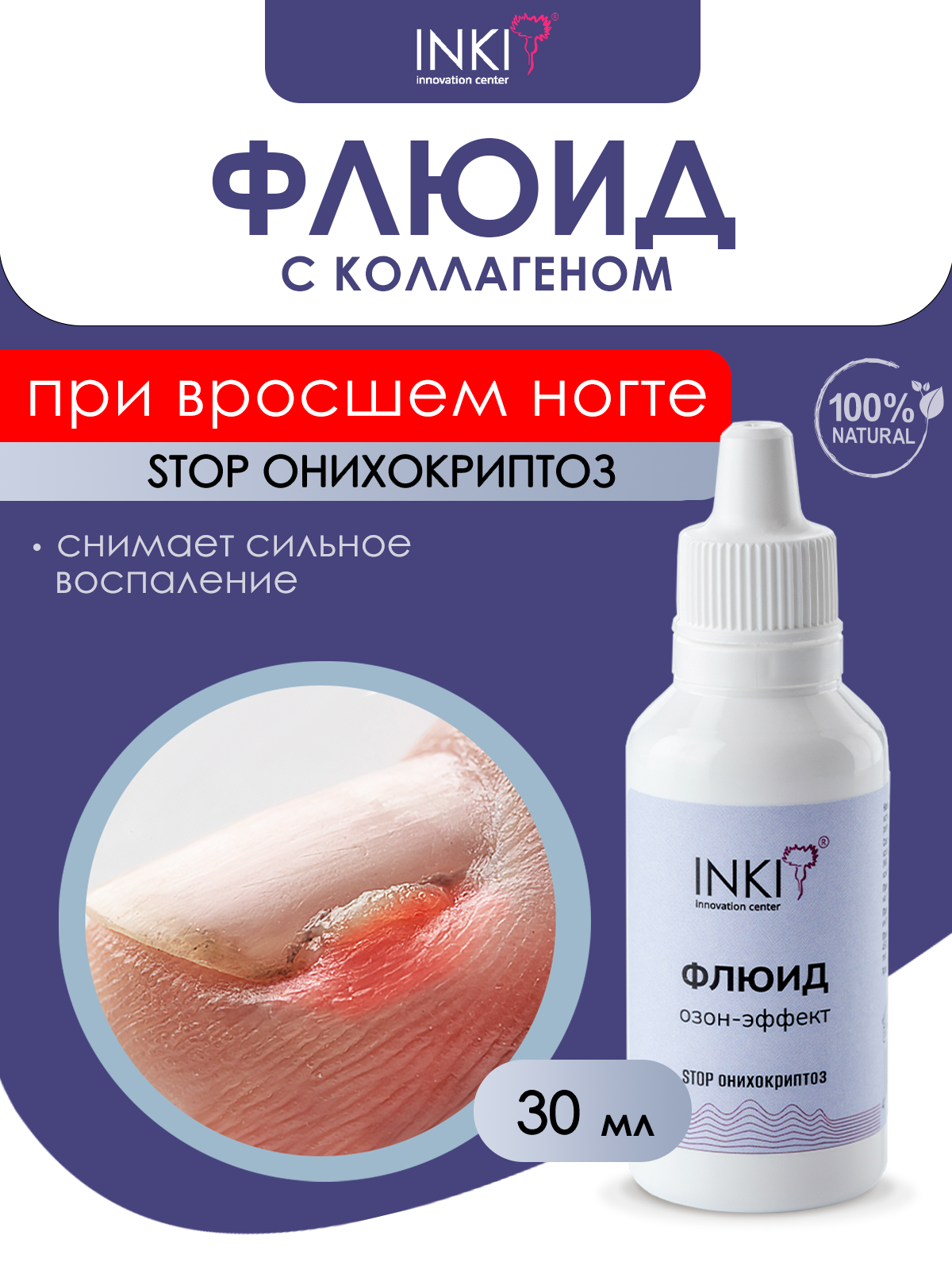 Флюид озон-эффект для лечения от вросших ногтей и кутикулы "STOP Онихокриптоз", 30 мл