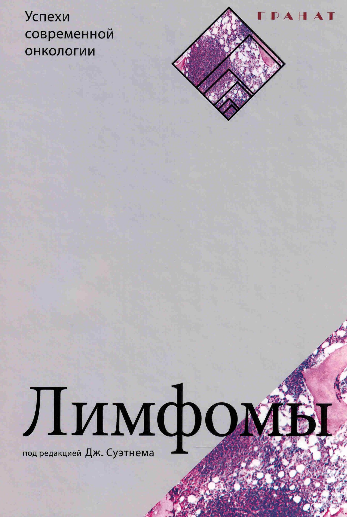 Лимфомы (Под ред. Дж. Суэтнема)