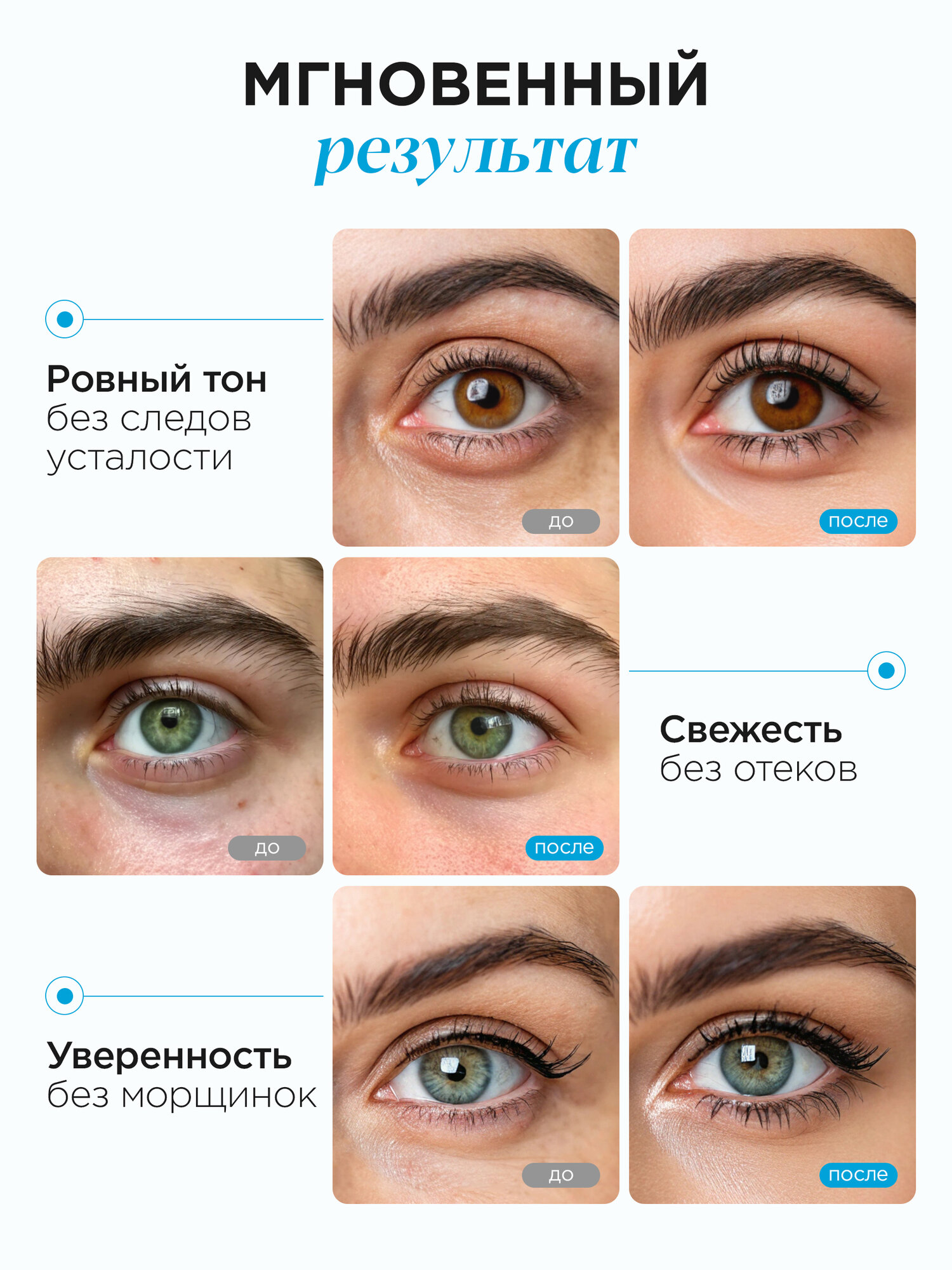 MIXIT Гидрогелевые патчи для глаз от темных кругов и отеков с лифтинг эффектом — фото 1