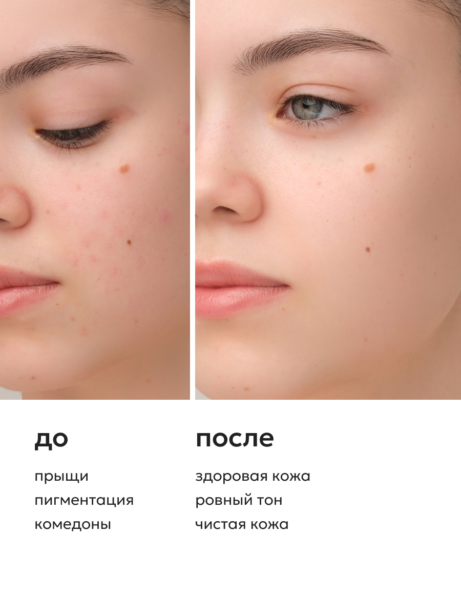 Скрабы И Пилинги Для Лица Likato Professional Кислотный кровавый пилинг для лица, от прыщей AHA+BHA 30%, 30 мл*2шт