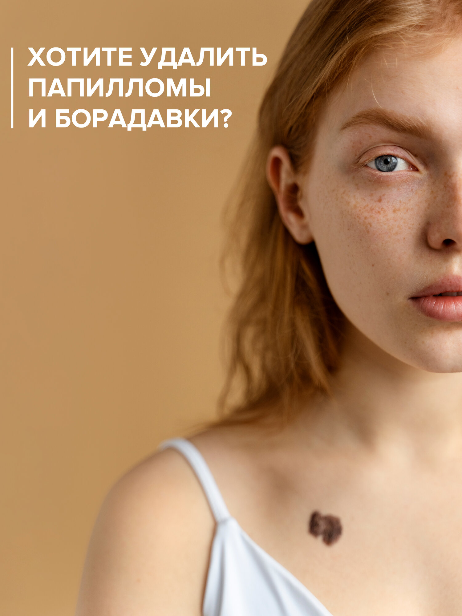 Плазменный коагулятор Evo Beauty для удаления папиллом, родинок, тату. Плазменная ручка косметологический аппарат — фото 1