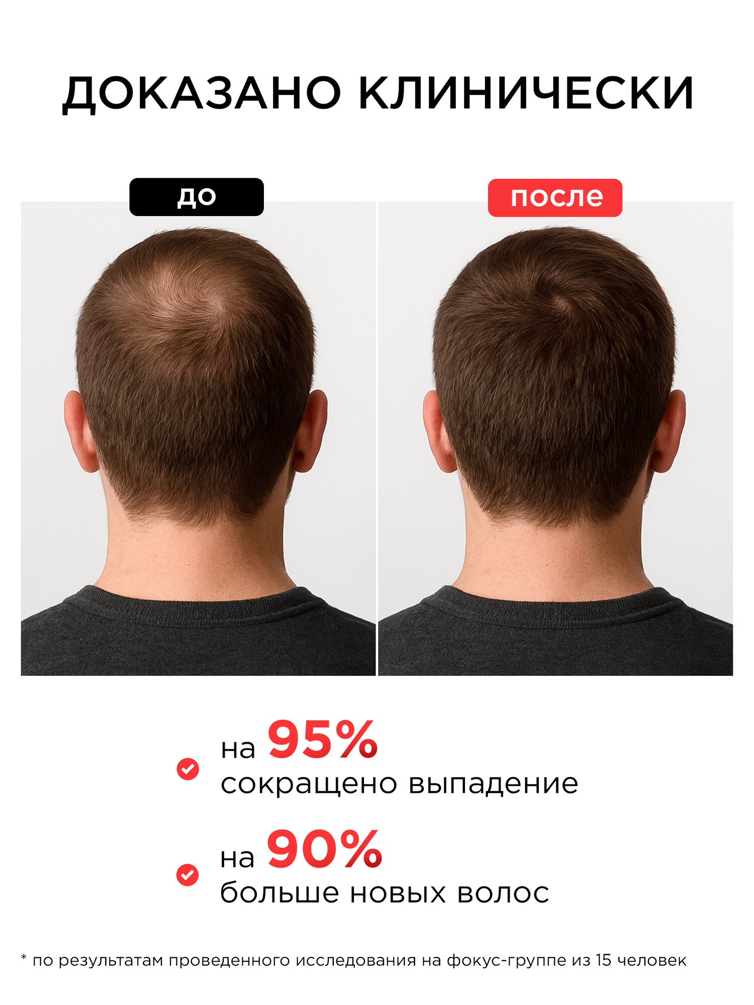 Cыворотка-спрей для роста волос MIXIT с красным перцем, 100 мл — фото 1