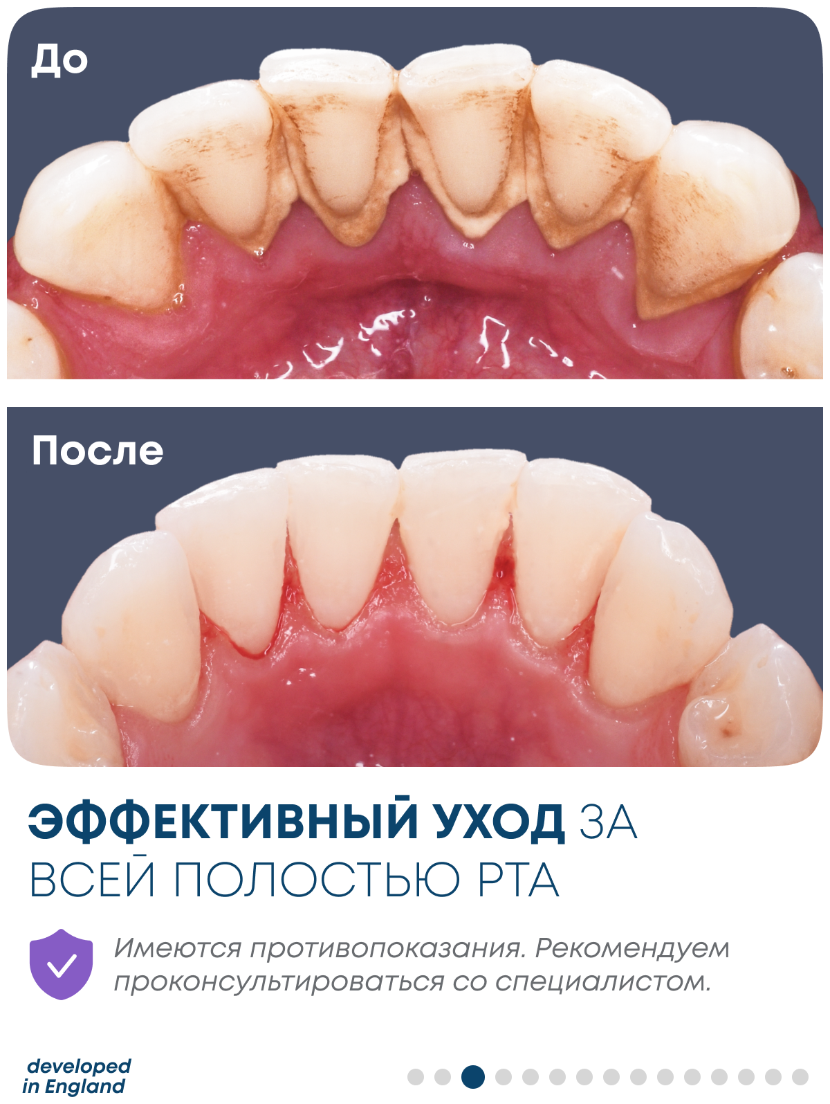 Sigil / Портативный ирригатор для полости рта Техника для здоровья и чистки зубов Иригатор c 4 насадками - фотография № 3