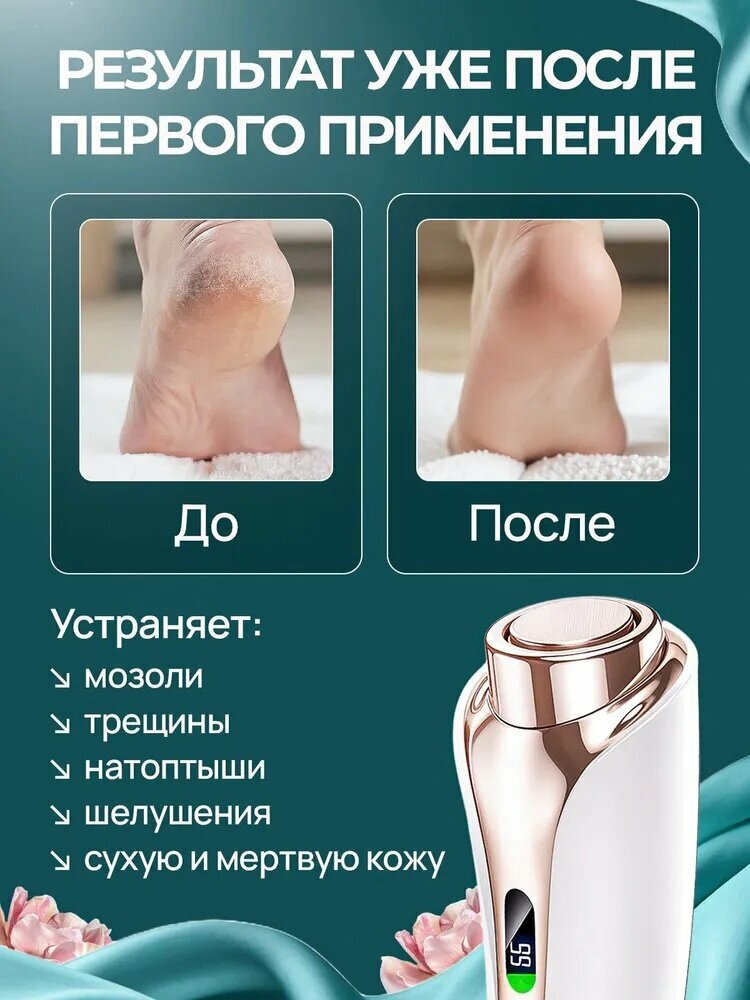 Картинки Xiaomi Роликовая пилка Электрическая пилка для пяток