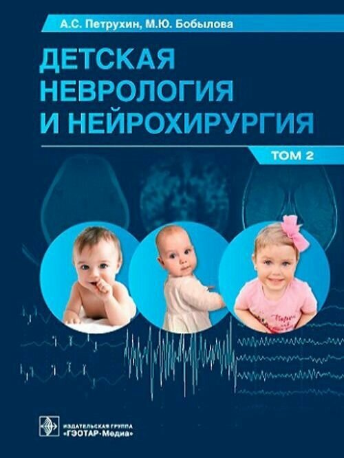 Детская неврология и нейрохирургия. Том 2. Учебник в 2-х томах