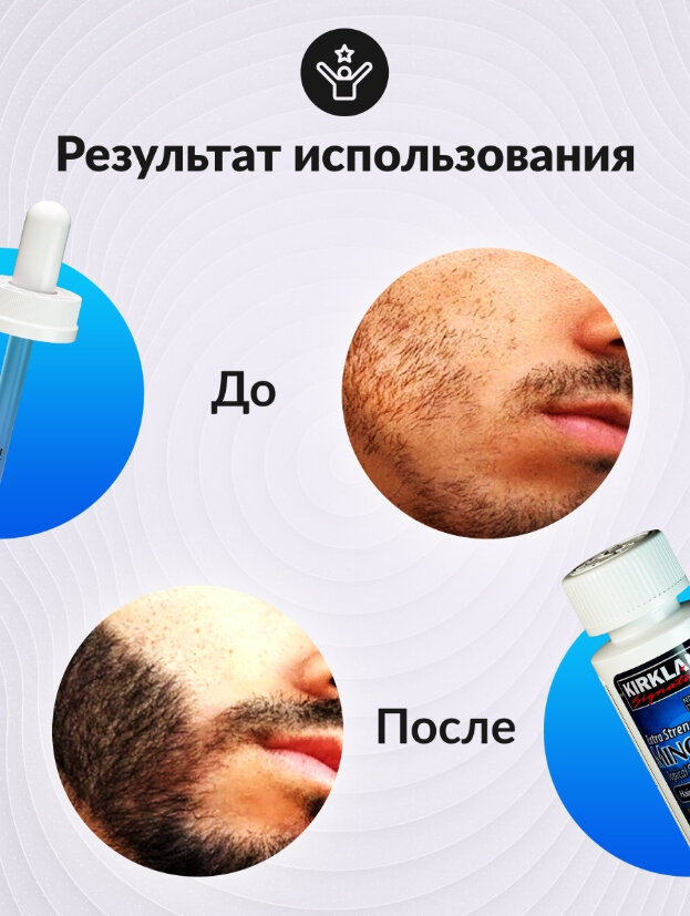 Миноксидил для роста волос и бороды Kirkland Minoxidil 5%, 60 мл — фото 1