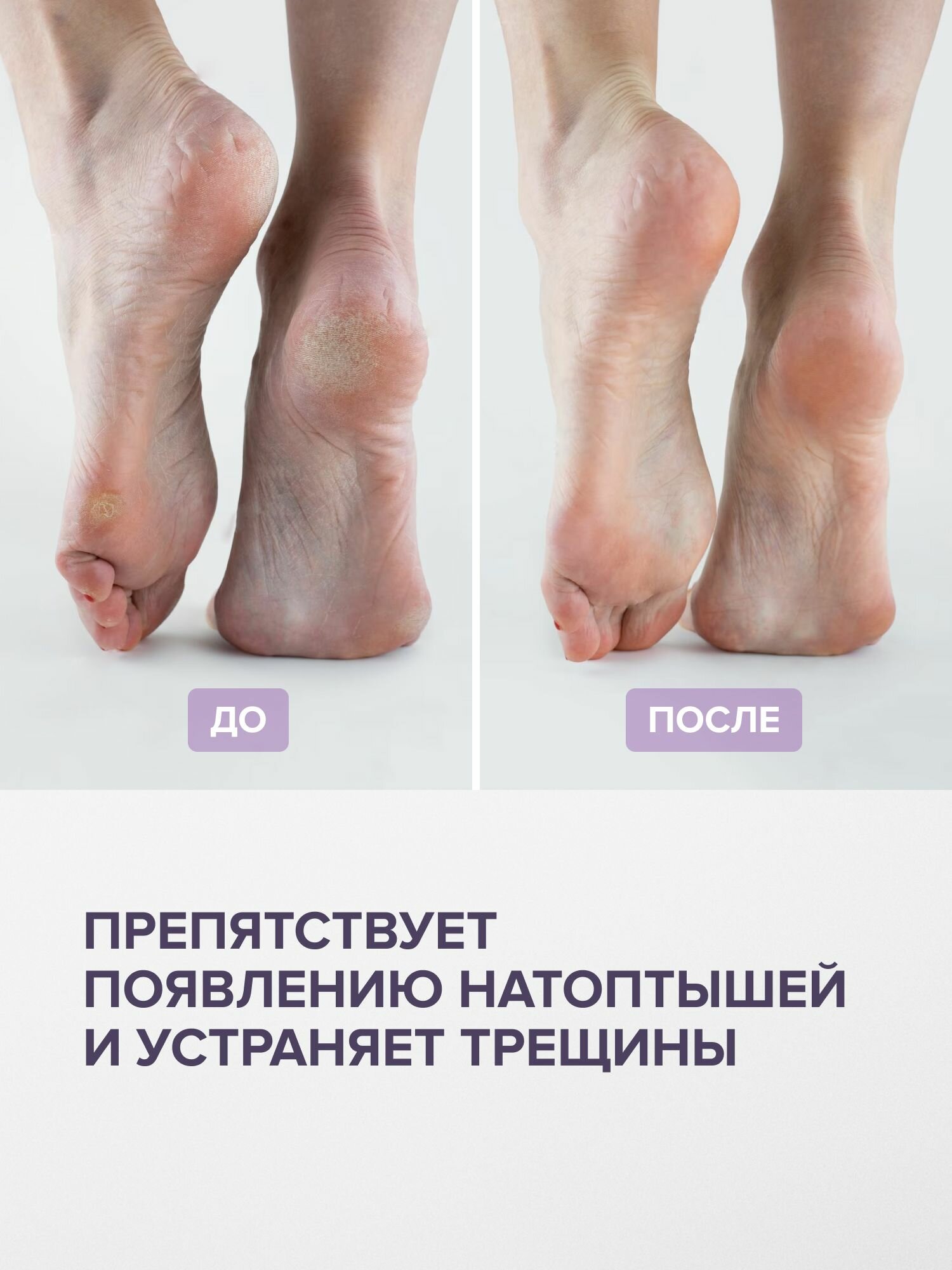 Крем для стоп с мочевиной питательный 150 мл — фото 1