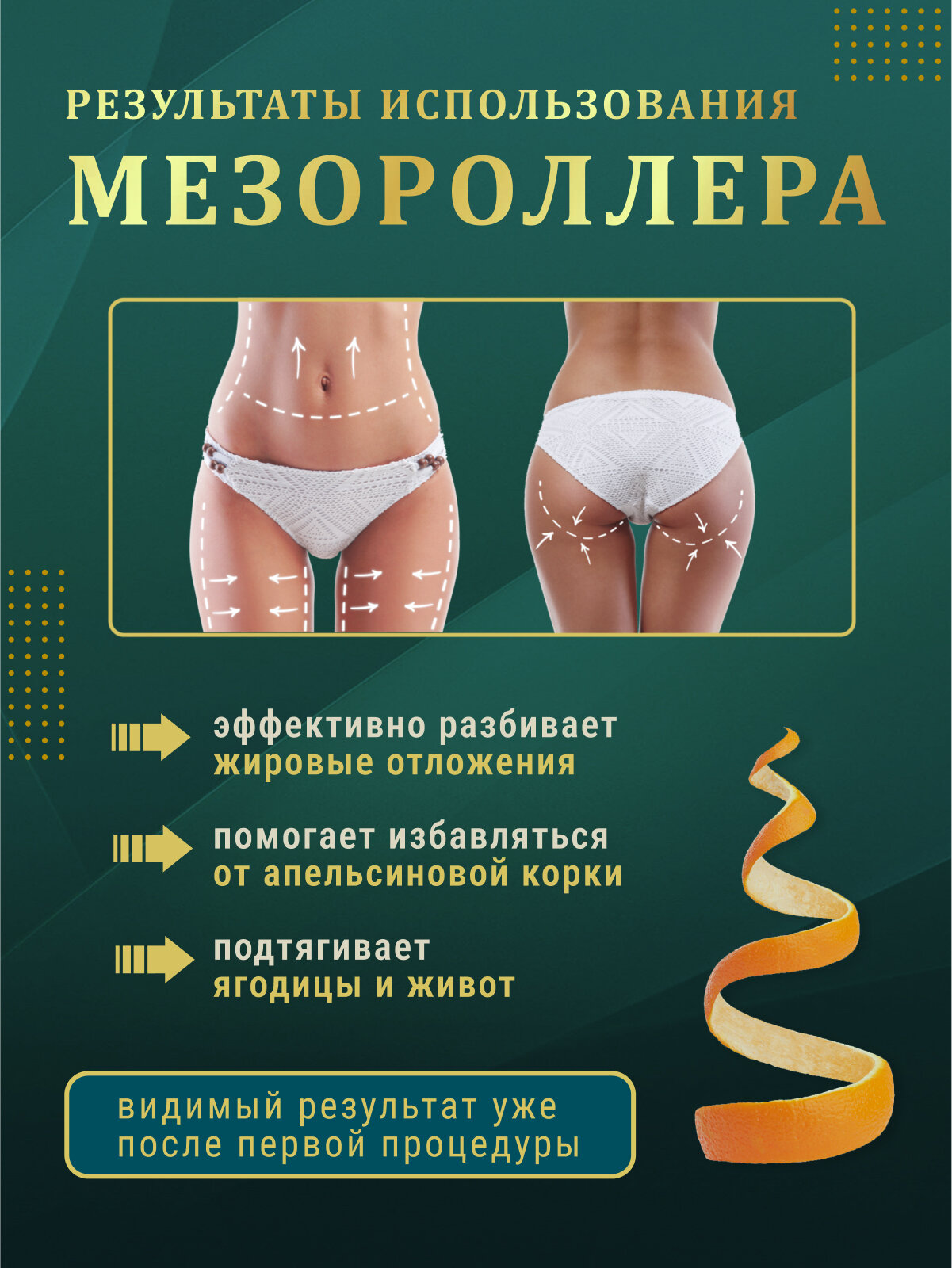 Изображение Мезороллер для тела от целлюлита и растяжек 3мм 1200игл, золотой