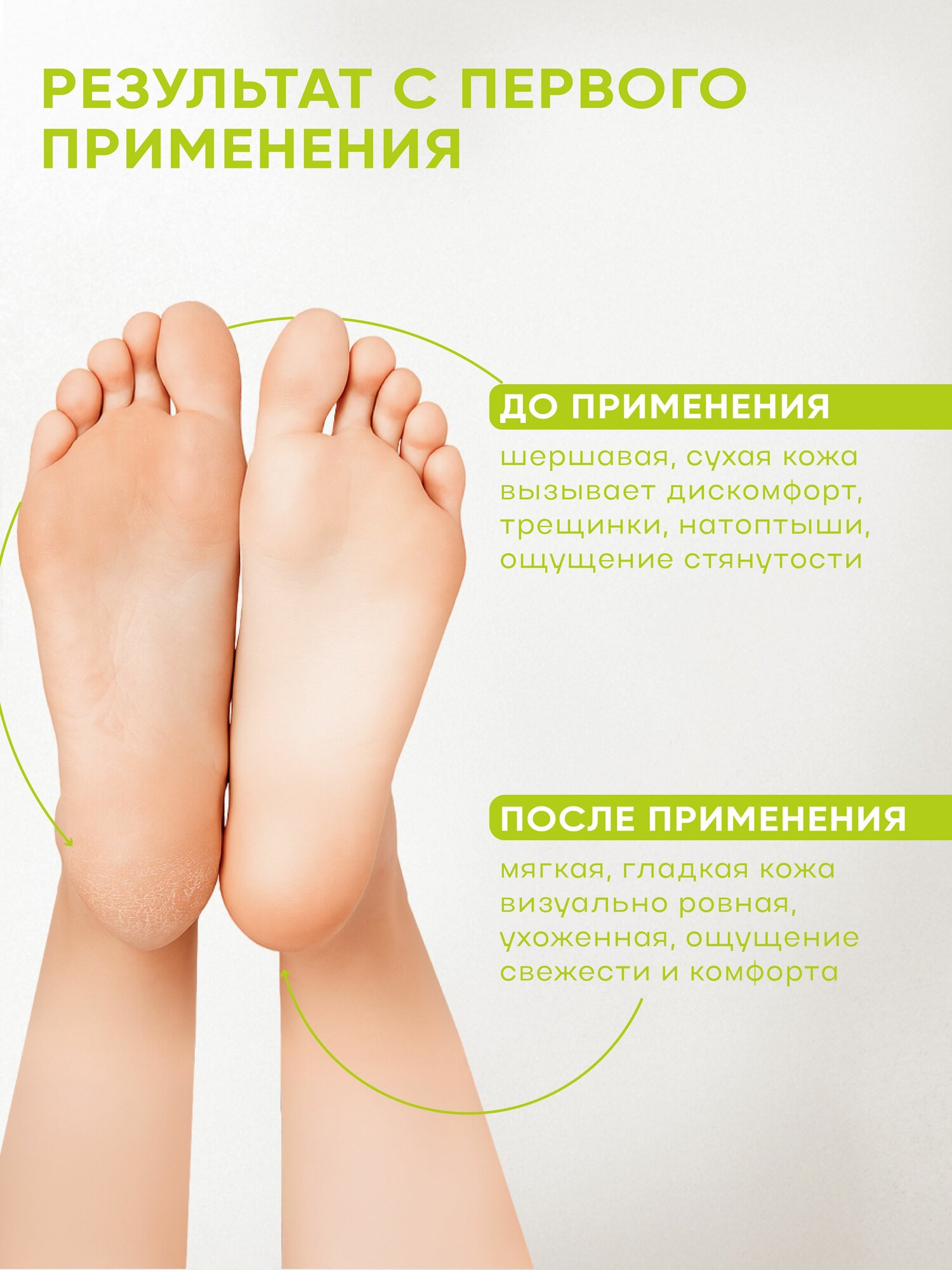 SKINLITE Отшелушивающие маски-носочки для ног, р.35-40, 2 шт — фото 1