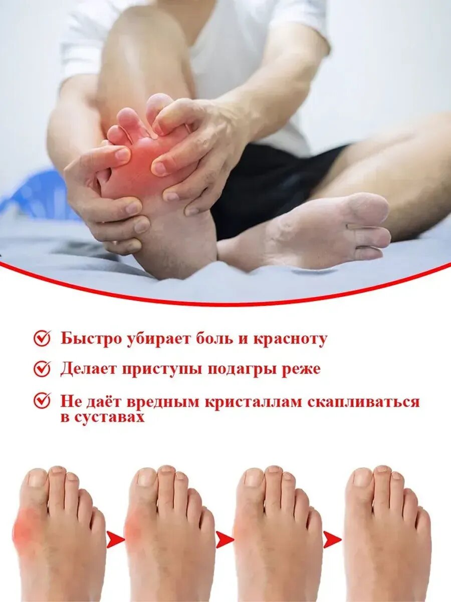 Препараты От Подагры Мазь от подагры на ногах китай