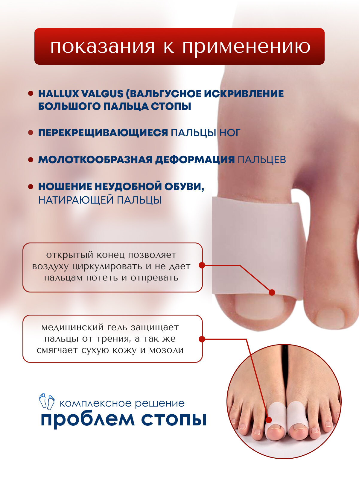 Напальчники от мозолей MyBalance, силиконовые, открытые, белые, эластичные, 2 шт, размер S — фото 1