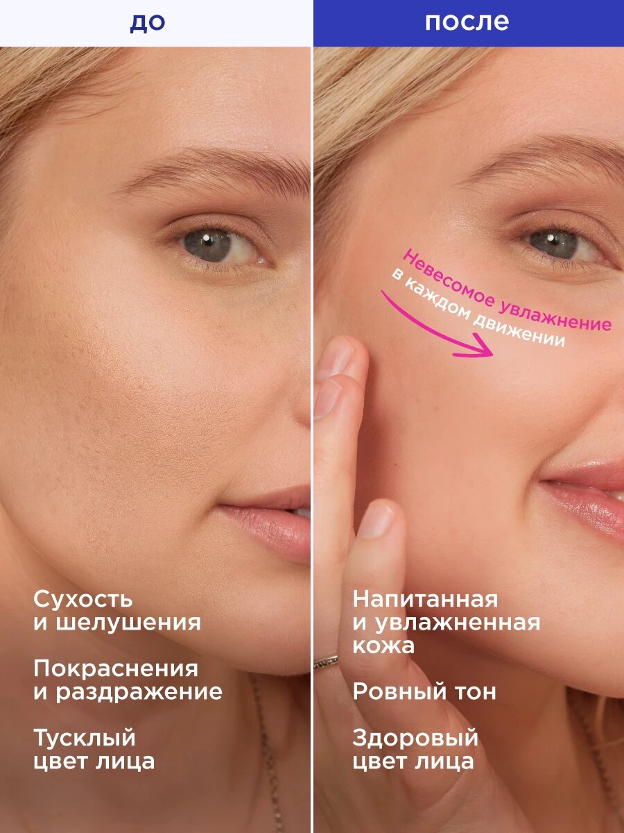 VOIS Крем для лица дневной матирующий SPF 15, увлажняющий, питающий, аллантоин пантенол 50 мл — фото 1