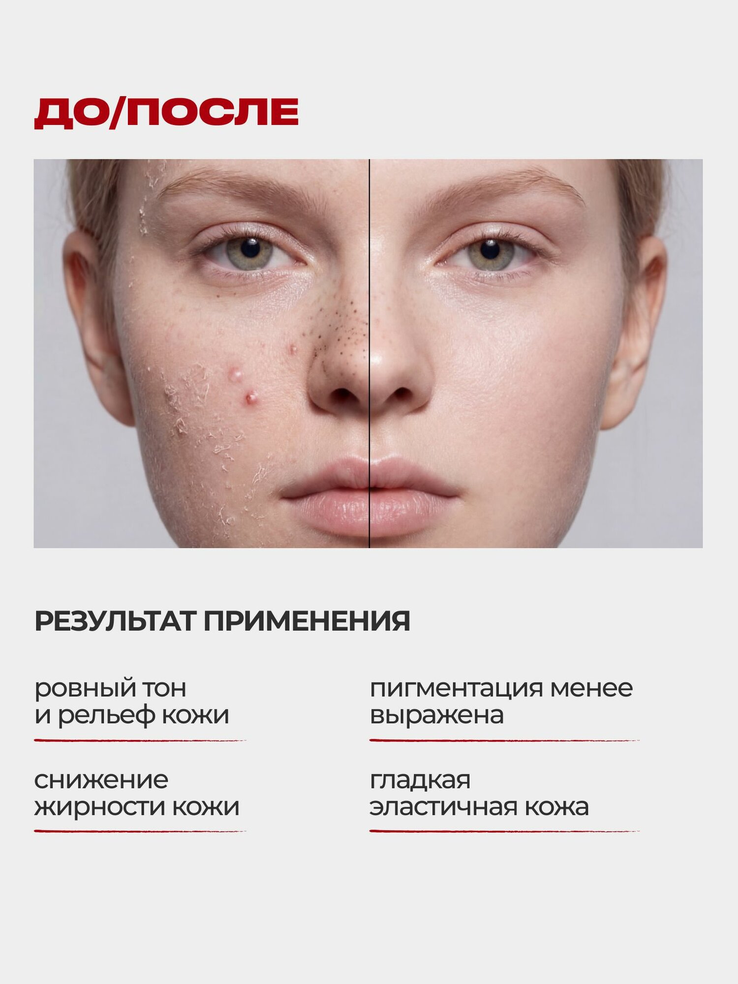 Пилинг для лица кровавый кислотный профессиональный c 10% AHA + 1.5% BHA MonoBeauty, 30 мл — фото 1