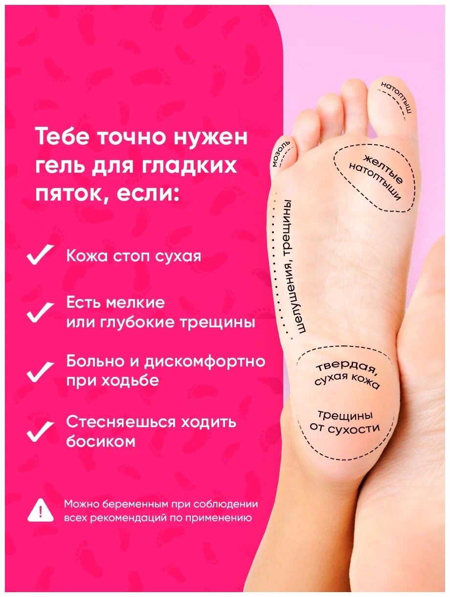 EpilProfi Гель для гладких пяток, средство для педикюра с мочевиной, 400 мл — фото 1