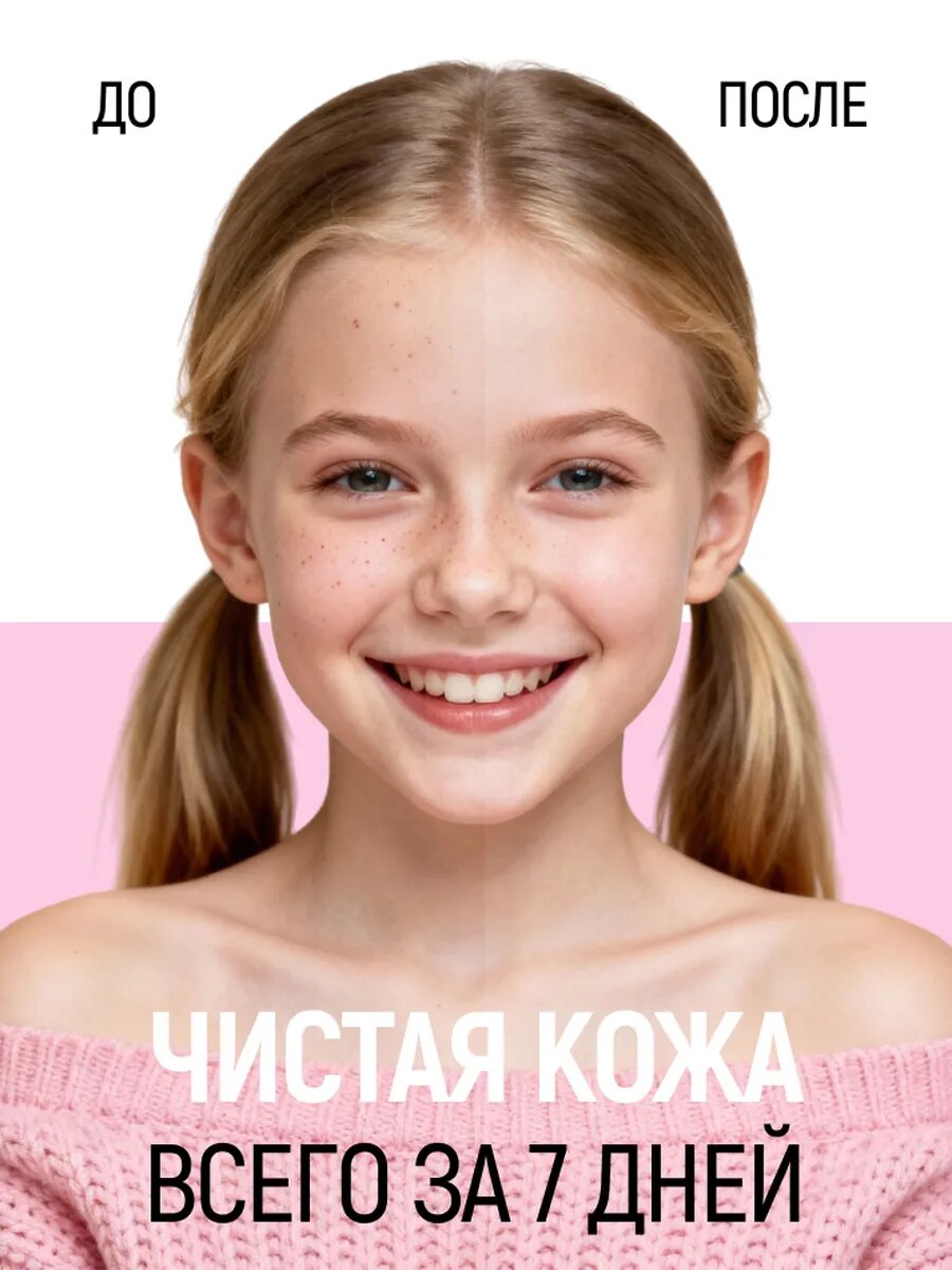 Крем Сиберина для лица матирующий, натуральный, против прыщей, угрей и черных точек для подростковой кожи, 50 мл — фото 1