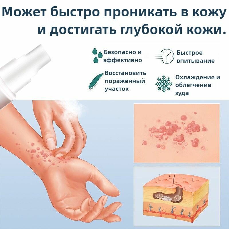 Препараты От Чесотки Американская формула спрей для ухода за кожей от чесотки, псориаза, экземы, дерматита и других кожных заболеваний, 30 мл