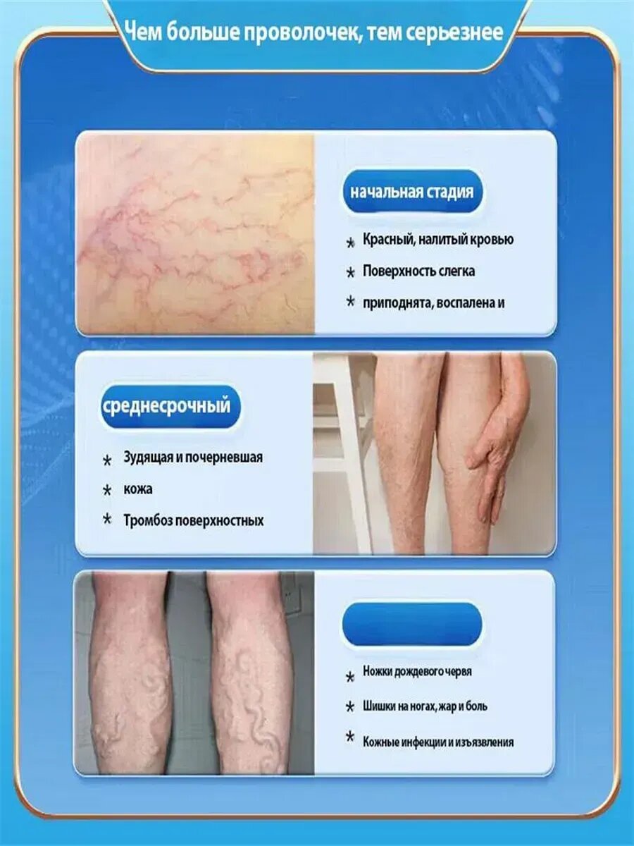 Картинки Пластырь от варикоза ног, отеков и тяжести в ногах, 8 шт