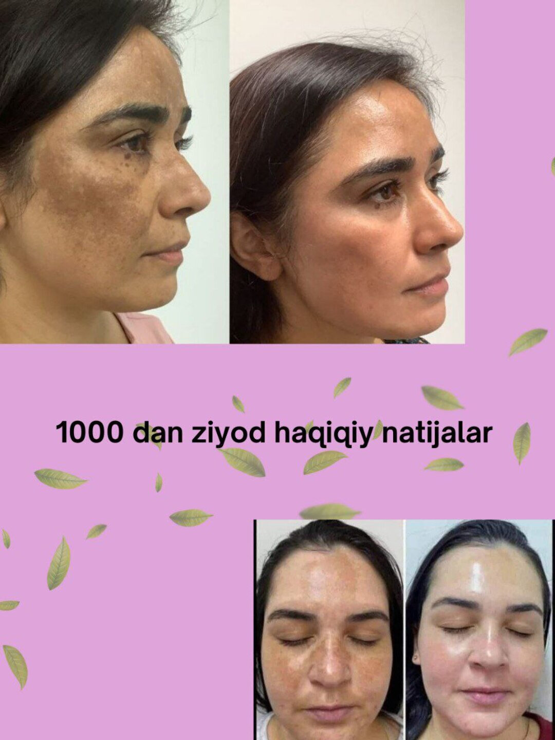 Маска MARJON, осветляющая и омолаживающая кожу лица, с витаминами