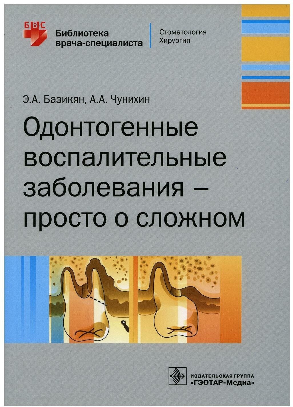 Одонтогенные воспалительные заболевания - просто о сложном - фото №1