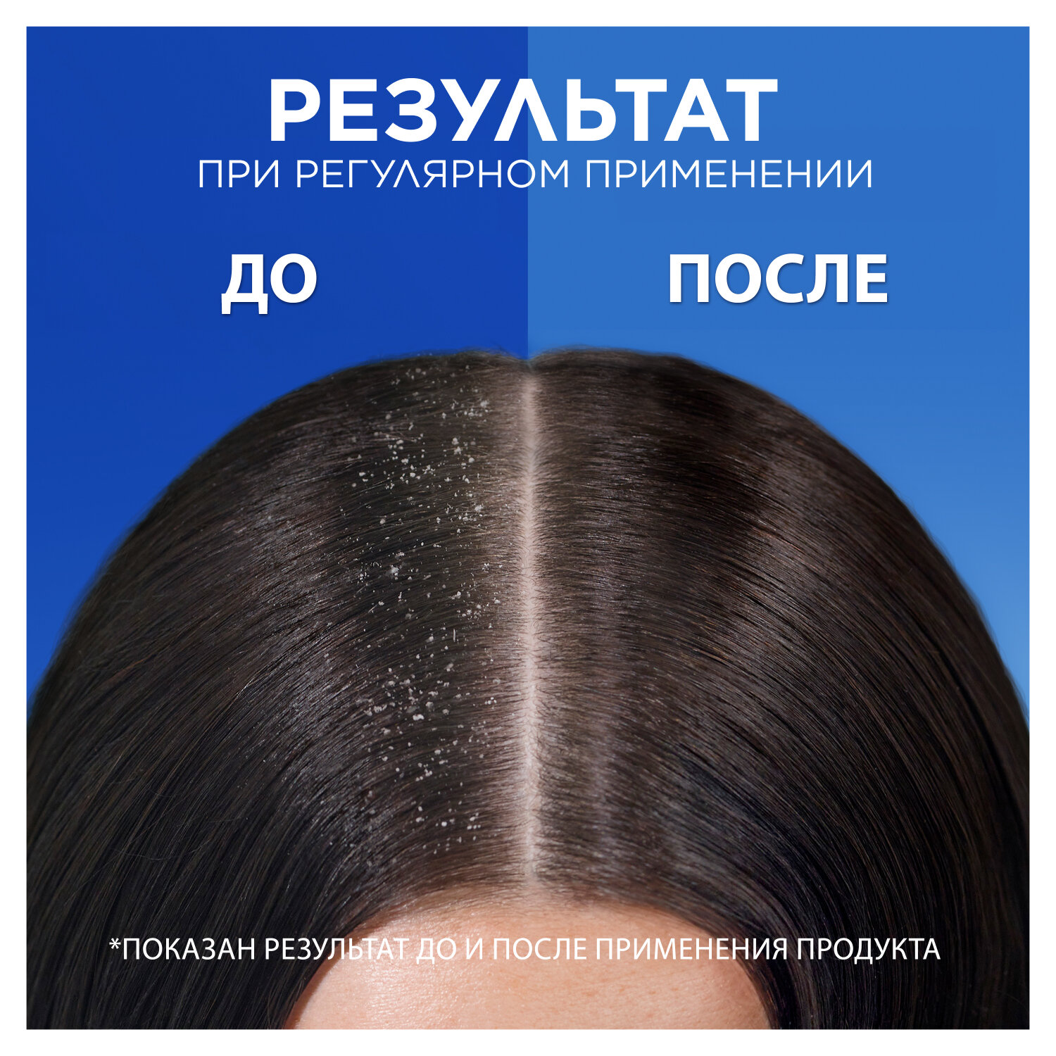 Pantene Набор для семьи Шампунь для волос Интенсивное Восстановление + Шампунь от перхоти 2в1 Основной уход, 900 мл