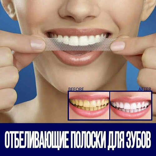 Отбеливающие полоски для зубов, 7 пар отбеливающие полоски для зубов 5d 14 саше 7 пар