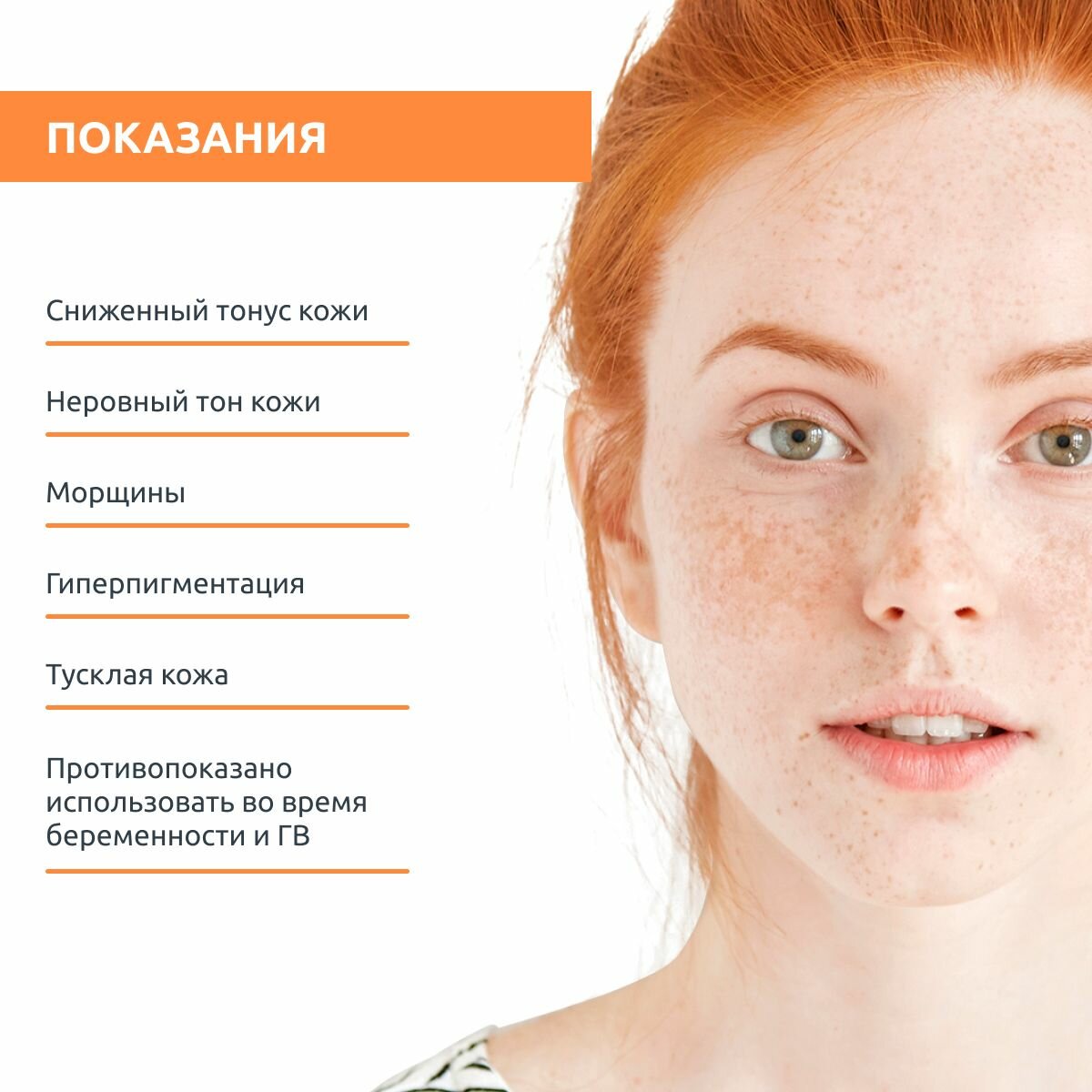 Sesderma Крем, корректирующий тон кожи , 30 мл (Sesderma, ) - фото №11