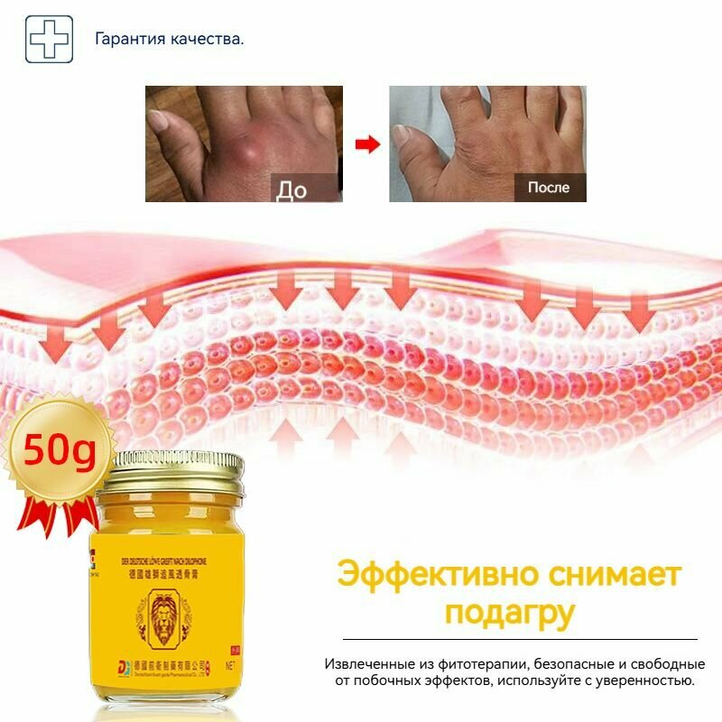 Картинки Немецкий Львиный крем для суставов обезболивающая, для лечения подагры, вальгусной деформации, суставов ног и рук от ушибов и растяжений, артрита, болей в мышцах,50 г
