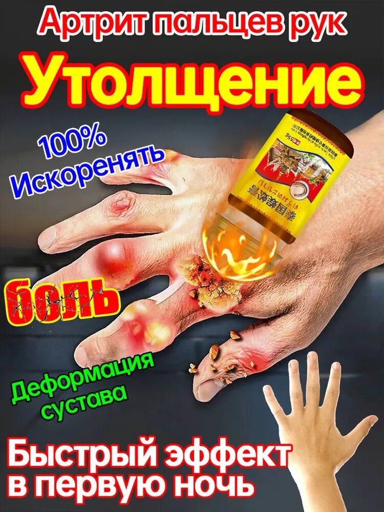 Мазь от подагры, Устранение боли при артрите, коленях, пальцах ног и т. д, на ноге и для рук и артрита 55 г