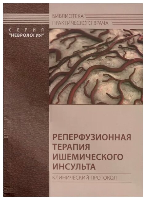 Реперфузионная терапия ишемического инсульта. Клинический протокол