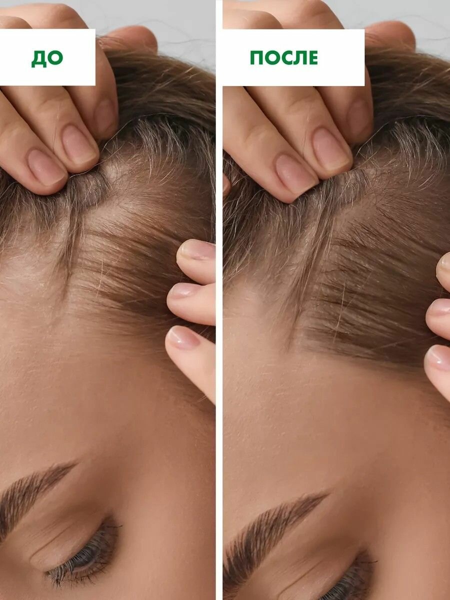 Обзор: Сыворотка активатор для роста волос Рецепты бабушки Агафьи Аптечка концентрат бустер от выпадения с перцем 2 шт х 150 мл