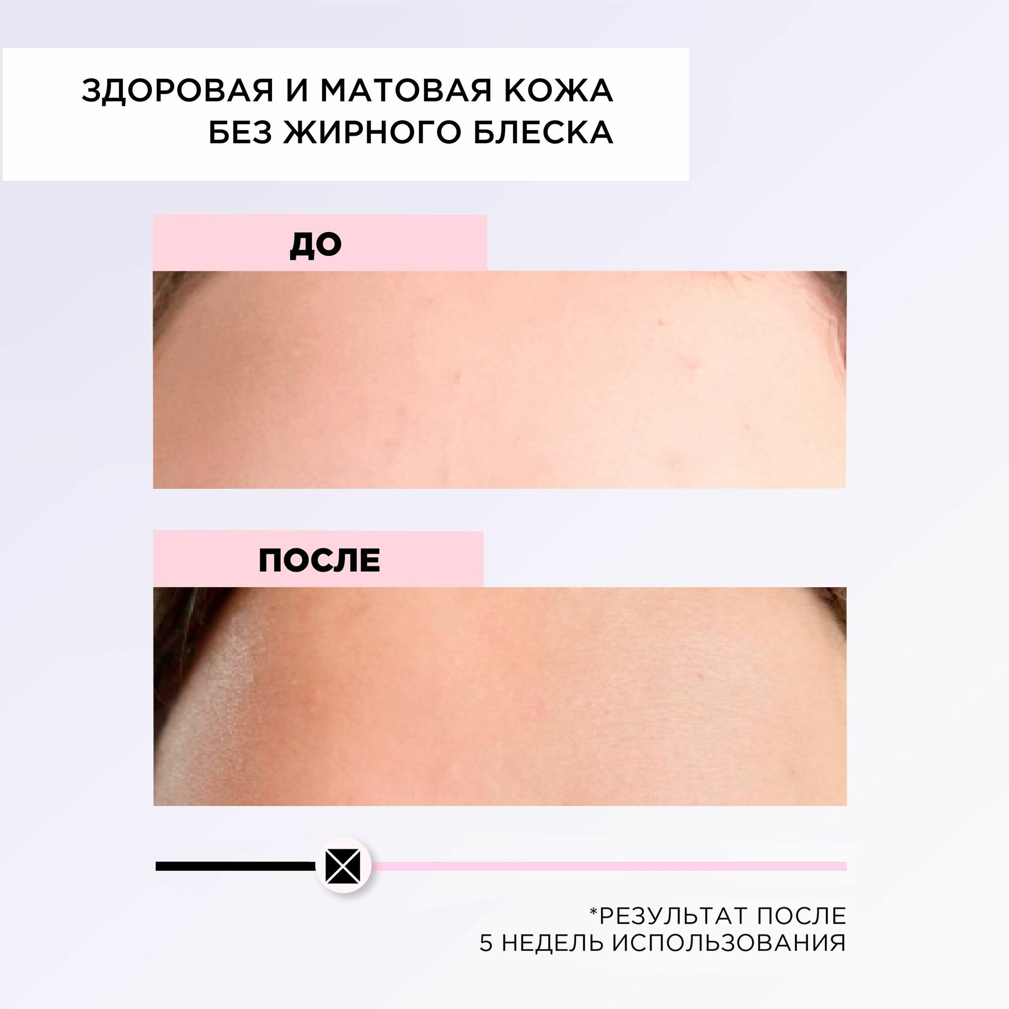 Крем для лица MiXiT Your Skin Normal to Oily Moisturizing Cream 50мл - фото №9
