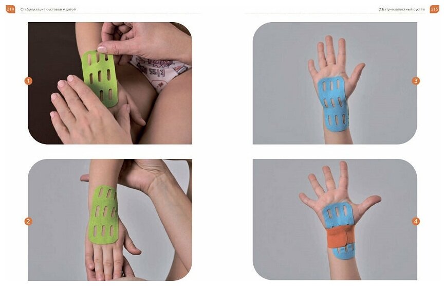 Кинезиологическое тейпирование в педиатрии — фото 1