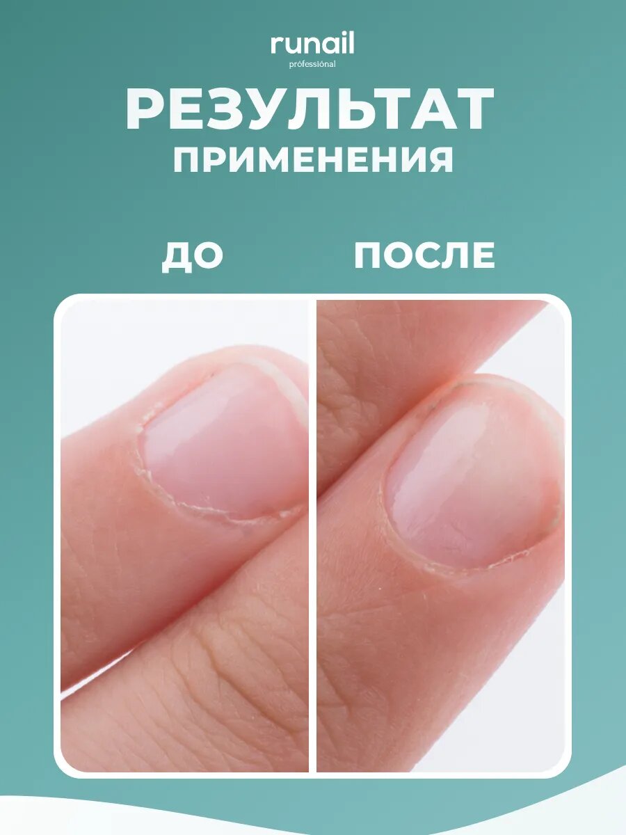 Картинки Runail Professional Кератолитик для удаления кутикулы, для маникюра и педикюра, ремувер для кутикулы 60 мл № 6652