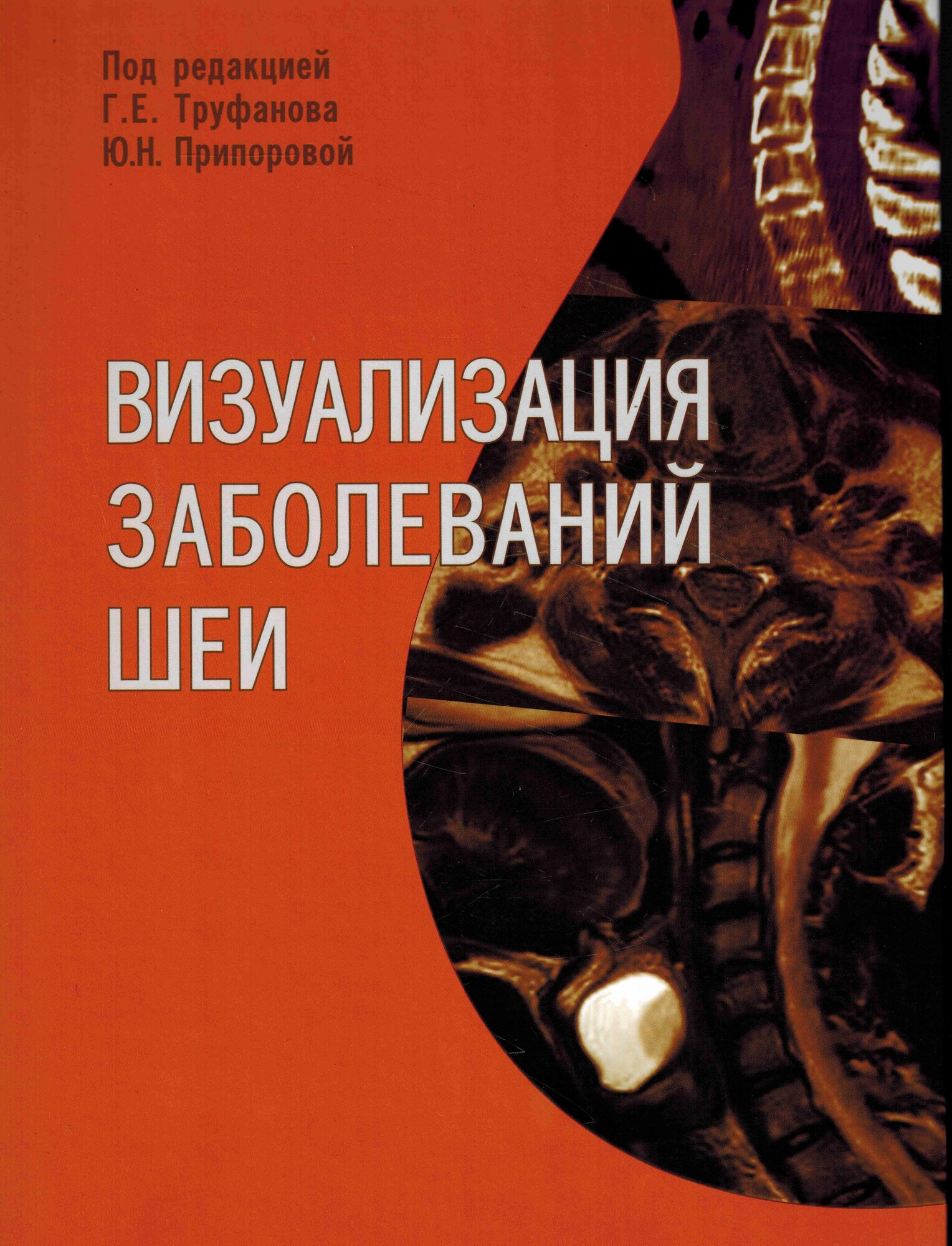 Визуализация заболеваний шеи