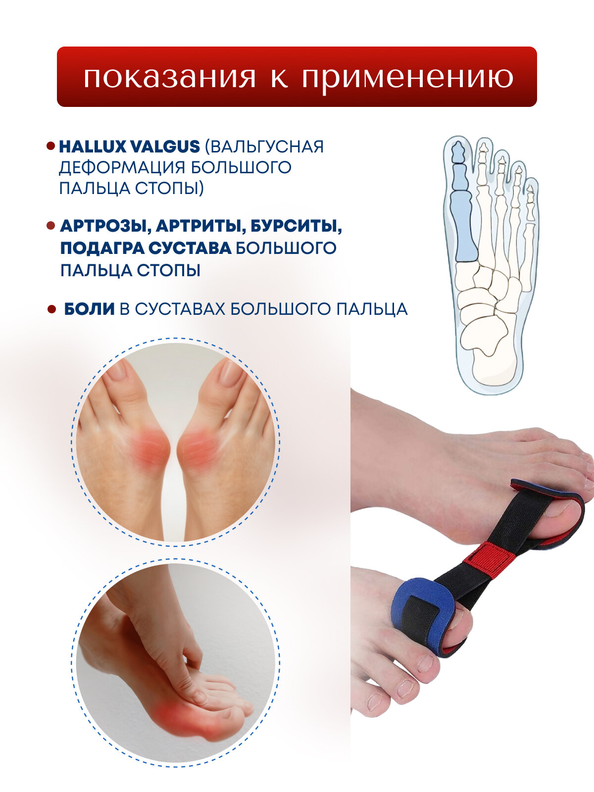 Картинки Тренажер для пальцев ног MyBalance при косточке на ноге, вальгусной деформации, универсальный, черный, 1 шт