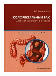 Колоректальный рак. Диагностика и тактика лечения - фото №1