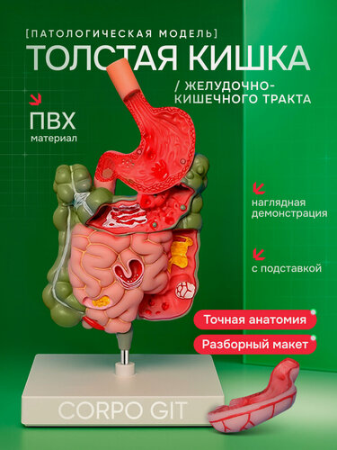Изображение товара Патологическая модель толстой кишки желудочно-кишечного тракта Corpo GIT