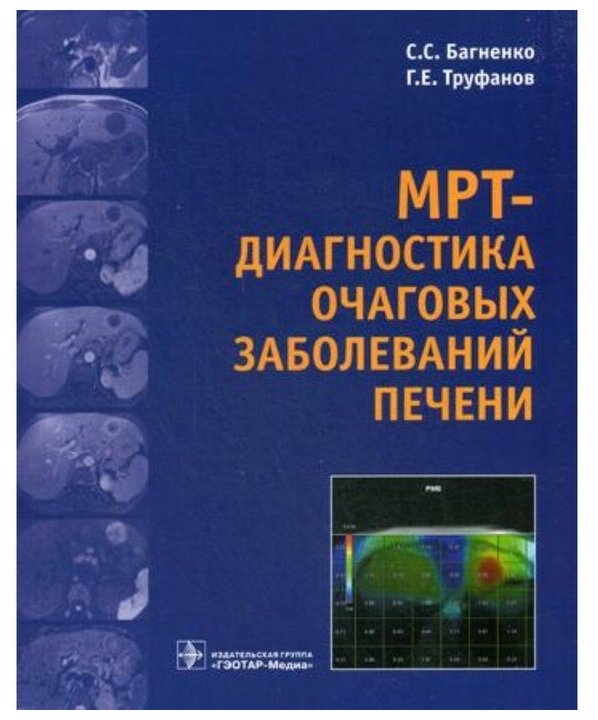 МРТ-диагностика очаговых заболеваний печени - фото №1