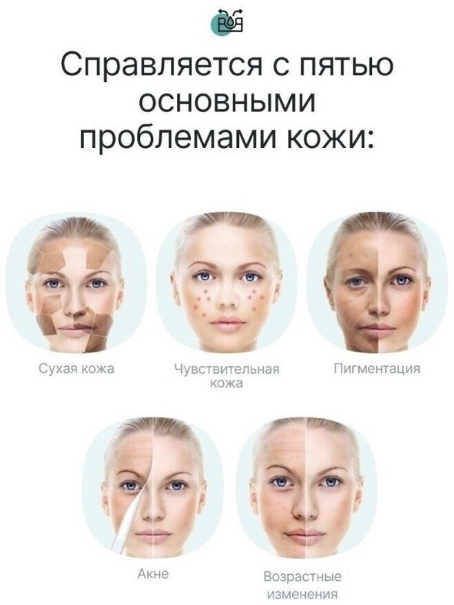 Паровая сауна для лица SK-6980/Для глубокого очищения кожи PERFECT SKIN/300 Вт/Белый-голубой - фотография № 4