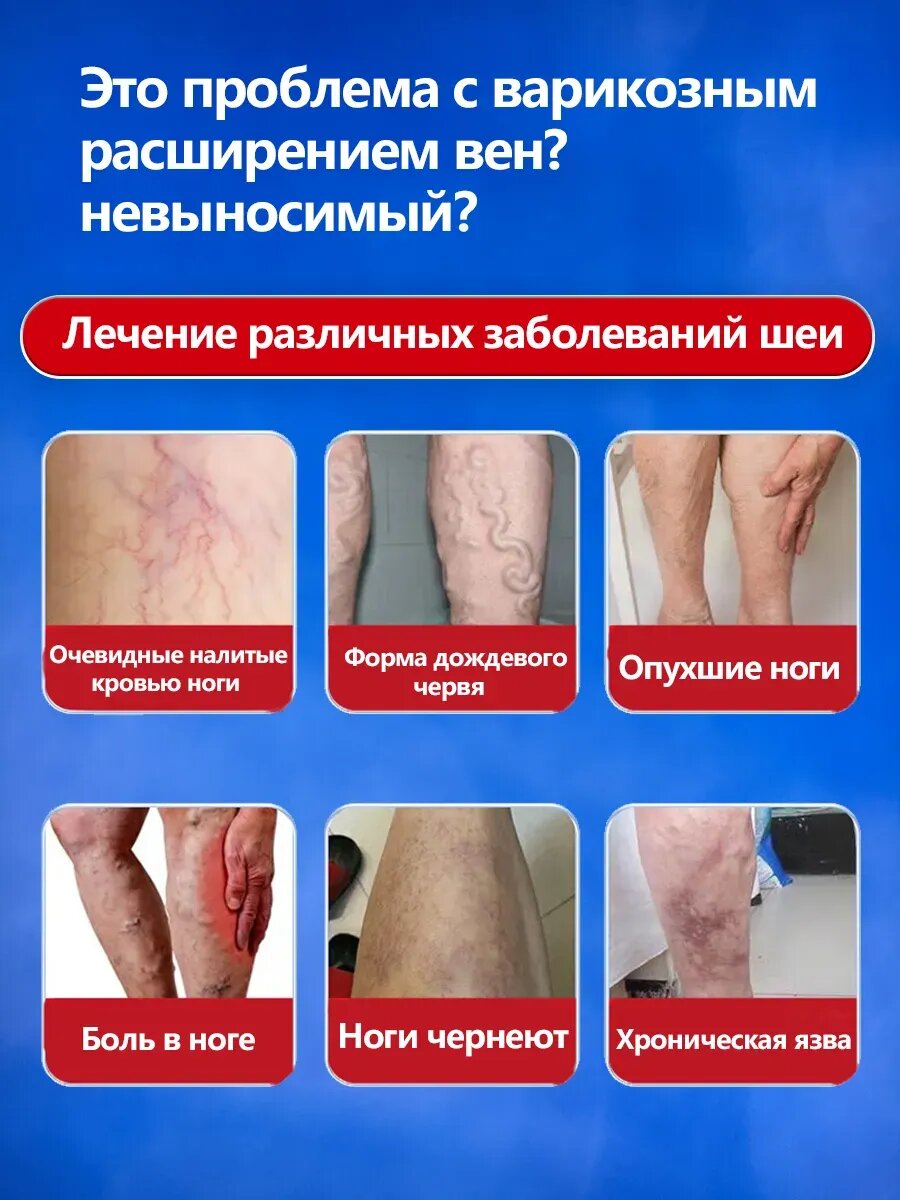 Картинки Пластырь от варикоза вен на ногах