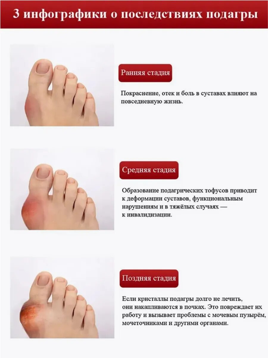 Картинки Мазь от подагры 55г