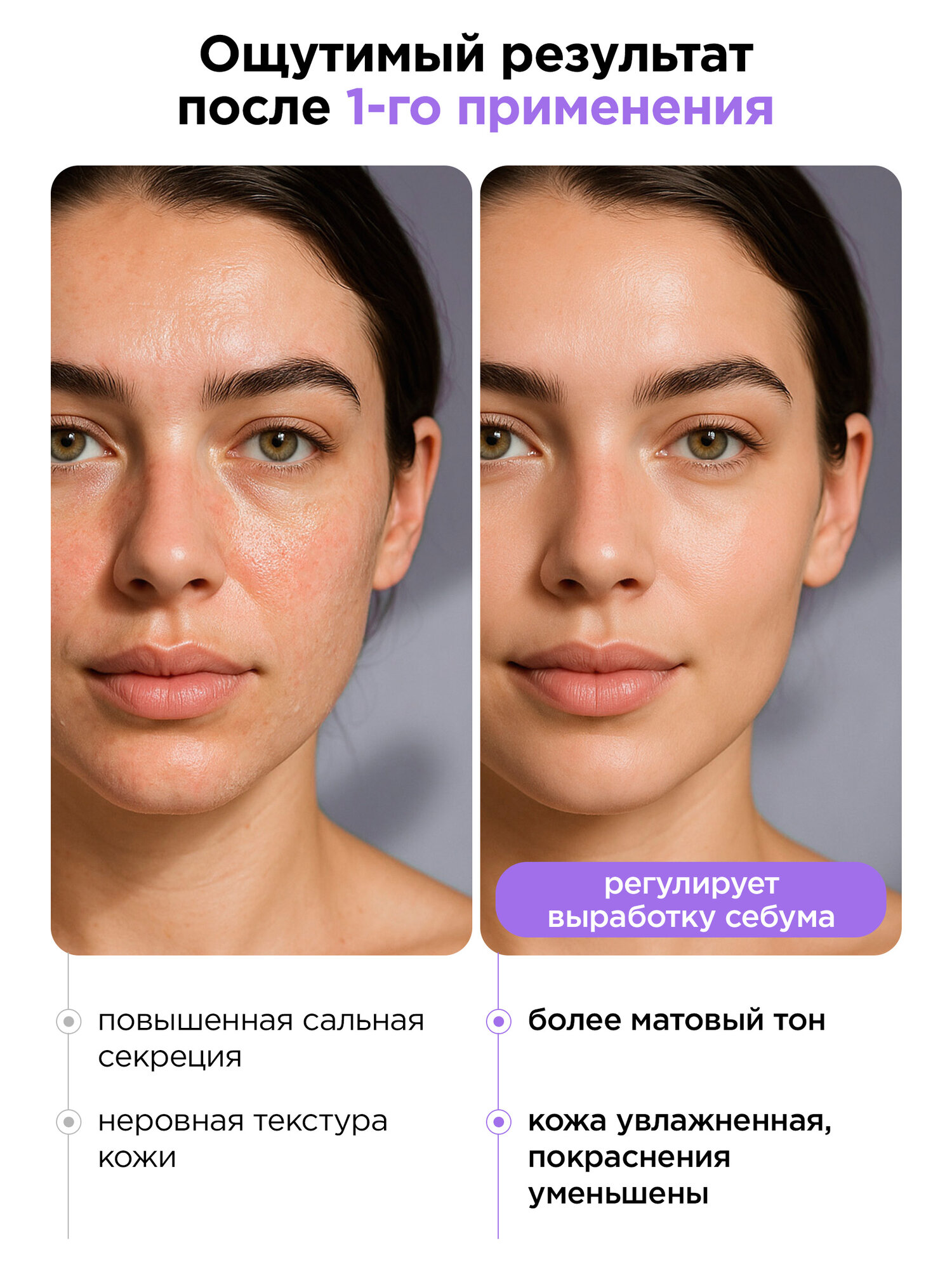 MIXIT Крем для лица увлажняющий матирующий с ниацинамидом и цинком LAB, 150 мл — фото 1