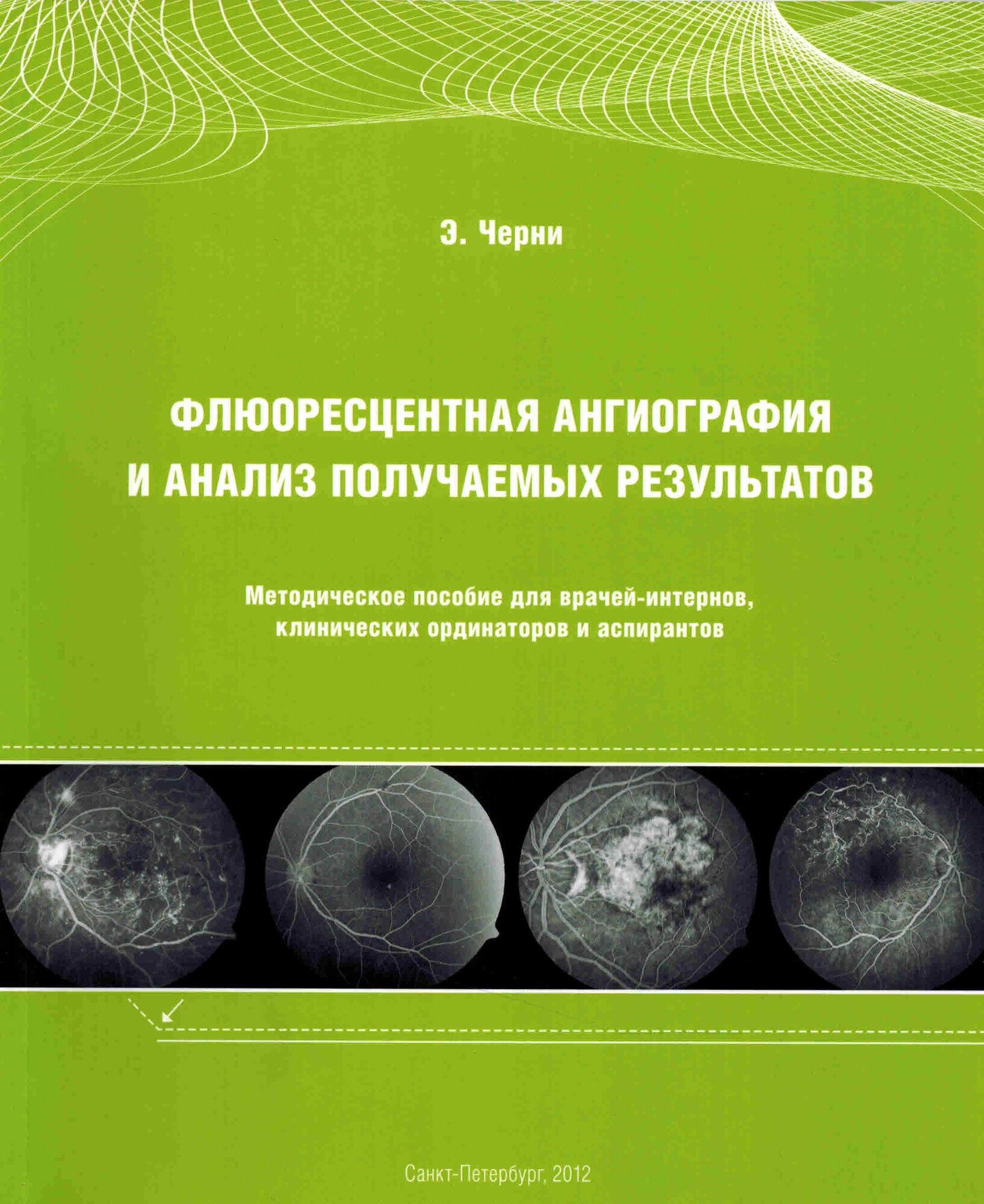 Флюоресцентная ангиография и анализ получаемых результатов