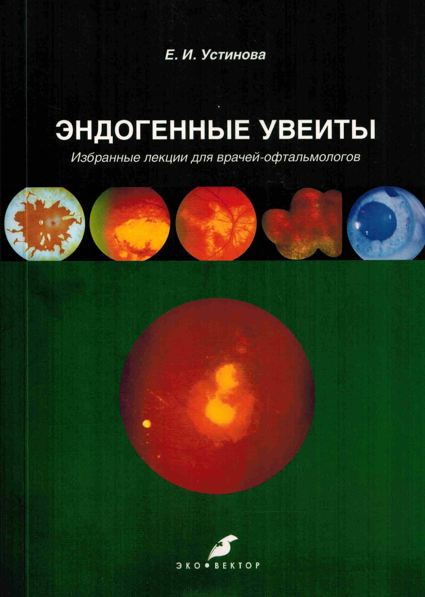 Эндогенные увеиты (2017 г.)