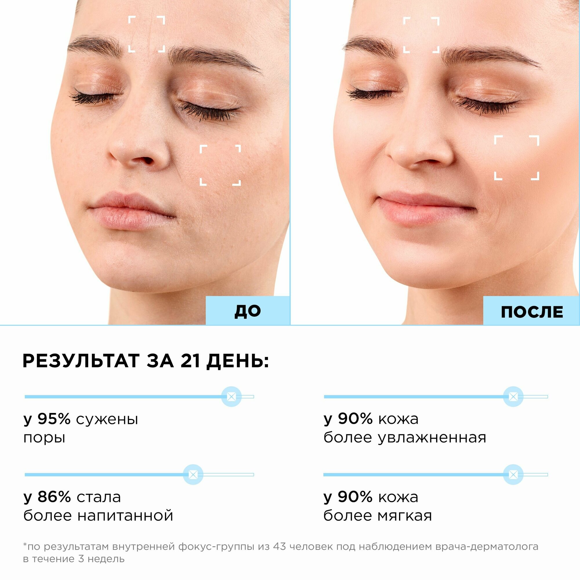 MIXIT Крем-гель для лица увлажняющий себорегулирующий с ниацинамидом LAB, 50 мл — фото 1