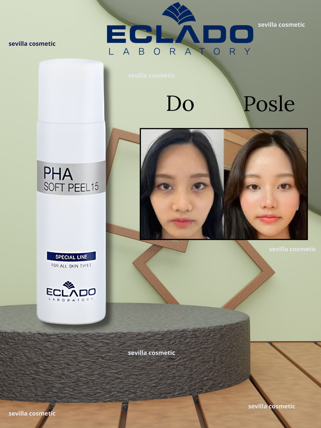 Eclado Soft Peel, пилинг для лица, Eclado PHA, средство для сужения пор — фото 1