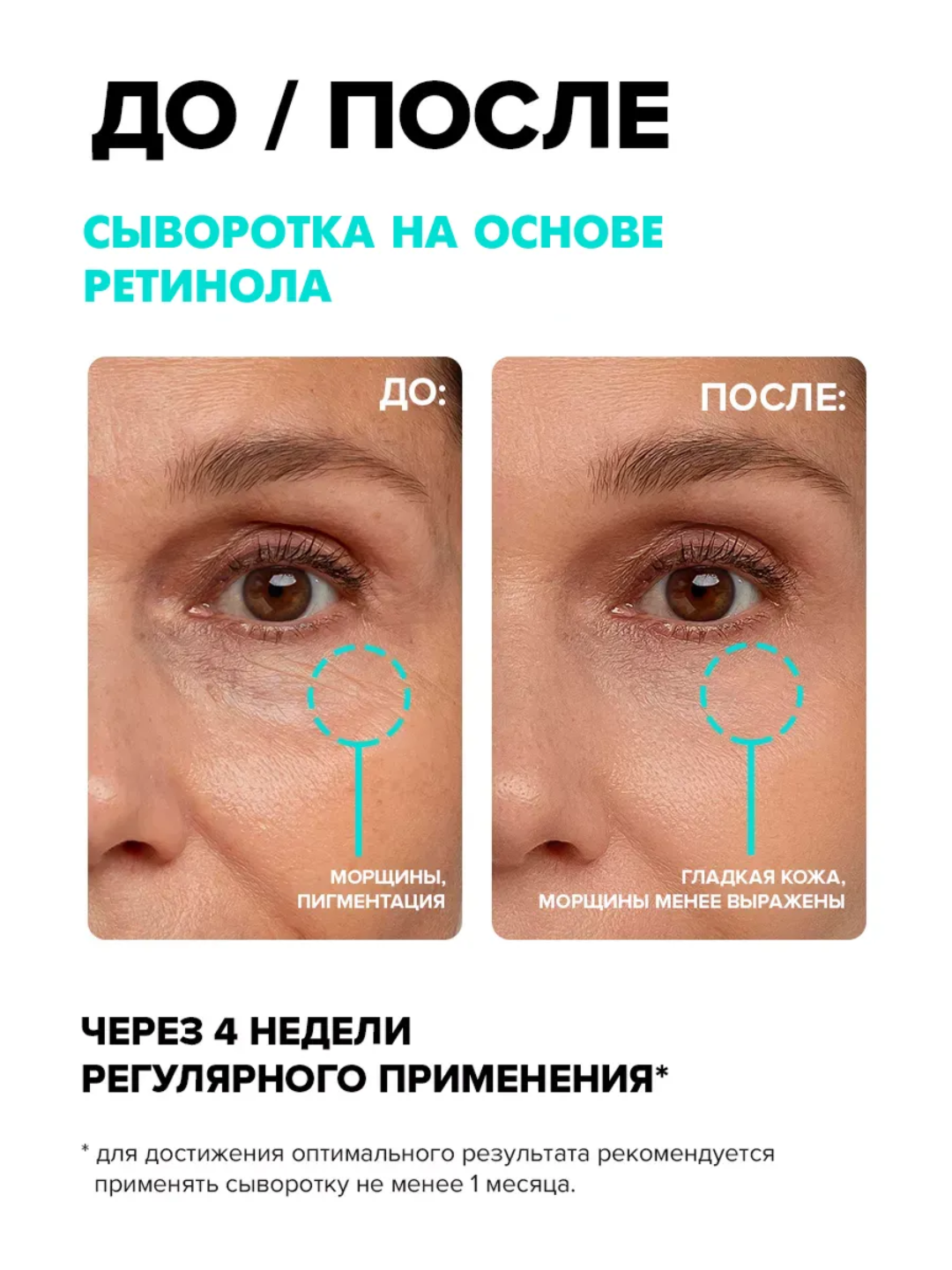 Сыворотка для лица от морщин антивозрастная, омолаживающая, пептиды+витамины — фото 1